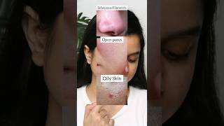 The Ordinary Niacinamide Vs Salicylic Acid Serum For Sebaceous Filament Open Pores amp Oily Skin [upl. by Deeann567]