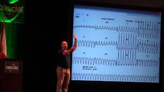 Understanding Ventricular Tachycardia [upl. by Ydnal]