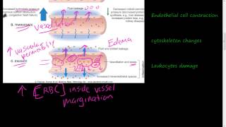 19  Acute Inflammation 1 of 3  Vascular permeability Vasodilation [upl. by Nosreme]