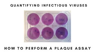 How to Perform a Plaque Assay [upl. by Htnamas]