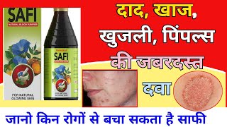 Safi syrup  पिंपल्स और खून साफ करने वाली दवा  safi syrup uses in hindi [upl. by Ramalahs]