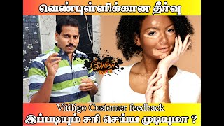 vitiligo treatment in trichy best vitiligo treatment in tamilnadu vitiligo cream vitiligo tattoo [upl. by Adnilav]