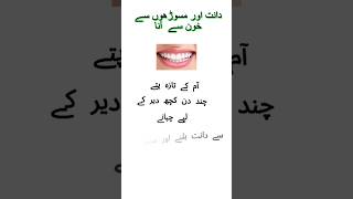 Masoro se khoon aane ka ilaj bleeding gums treatment bleedinggums trending viralvideo shorts [upl. by Pastelki]