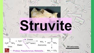 struvite [upl. by Nire351]