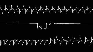 C64 Jeroen Tels quotRoboCop 3quot oscilloscope view [upl. by Aysan75]