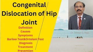 Congenital Dislocation of the Hip Joint [upl. by Theodor107]