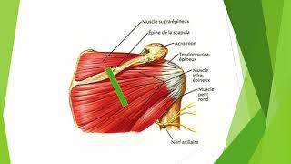 Exploration du tendon infra épineux en échographie [upl. by Angadreme]