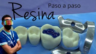 Como hacer una resina dental paso a paso [upl. by Ahseket]