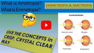 WHAT IS EMMETROPIA  WHAT IS AMETROPIA [upl. by Amehr883]