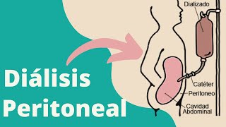 ¿Qué es la diálisis peritoneal [upl. by Sibylla952]