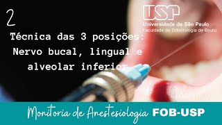 Técnica das 3 Posições  Anestesia dos Nervos Bucal Lingual e Alveolar Inferior  Monitoria FOBUSP [upl. by Jacquelin204]