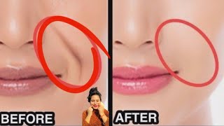 ♨️Face yoga to remove smile linemarionette lines wrinkles free faceyoga rupalrjfitnessbeauty [upl. by Tabbatha858]