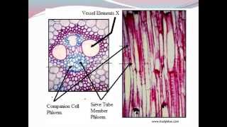 IGCSE 27 Translocation [upl. by Moulden]