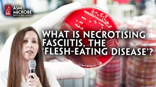 What Is Necrotising Fasciitis The ‘FleshEating Disease’ [upl. by Burne]