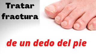 FRACTURA DE DEDO DEL PIE TRATAMIENTO [upl. by Soble]