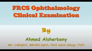 Clinical Ocular Examination  Part 2 Pupil Examination Part 2 amp Confrontation Test [upl. by Airamalegna53]