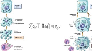 Mechanisms of cell injury [upl. by Shatzer]