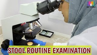 Stool Routine examinationStool analysis in laboratory MLT WORLD [upl. by Brien]