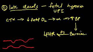 Intro to Fetal Heart Tracings  Decelerations 07 of 11 [upl. by Meit840]