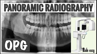 PANORAMIC RADIOGRAPHY II OPG II EXTRAORAL RADIOGRAPHY II ORAL RADIOLOGY [upl. by Alyahc922]