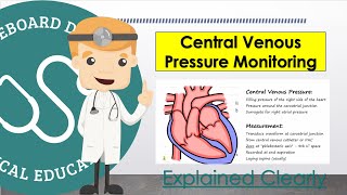 Central Venous Pressure CVP Monitoring and Measurement Basics [upl. by Codi]