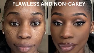 PITTED ACNE SCAR MAKEUP TUTORIAL STEP BY STEP ICEPICK SCARSBOXCAR SCARSCRATERS [upl. by Merell]