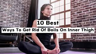 10 Best Ways To Get Rid Of Boils On Inner Thigh [upl. by Dedra]