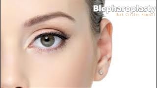 ❉ Powerful Blepharoplasty  Dark Circles amp Eye Bags Removal  Radiant Youthful Skin  Ocean Sounds [upl. by Adelpho]