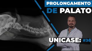 UNICASE 38  Prolongamento de palato [upl. by Moll]