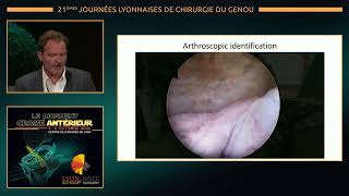 JLG24 J2 Sympo Arthrex [upl. by Aneryc]