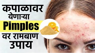 कपाळावर येणार्‍या Pimples मागचे कारण आणि उपाय  Skin Care Routine  Face Wash  Serum  MA2 [upl. by Larena]