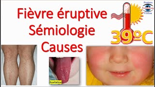 Fièvre éruptive Sémiologie Éruption erythemato maculo papuleuse vésiculeuse purpura Toxidermie [upl. by Bobby814]