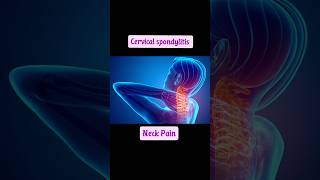 cervical pain exercise neck pain [upl. by Errehs]