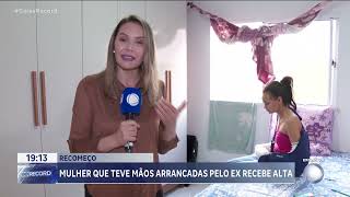 MULHER QUE TEVE MÃOS ARRANCADAS PELO EX RECEBE ALTA [upl. by Saffian]