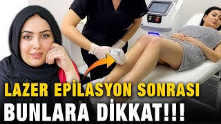 Lazer Epilasyon Sonrası Yapılması Gerekenler Bunlara Dikkat [upl. by Linnette639]