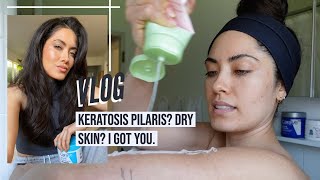 This is how I manage my Keratosis Pilaris KP and dry skin on my body  Melissa Alatorre [upl. by Esilehs583]