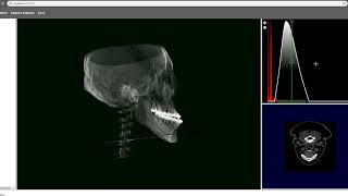 3D CT Visualization Web Demo volume rendering [upl. by Nyrhtakyram605]