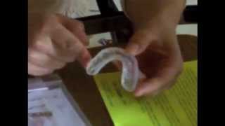 ProDental 3in1 Mouth Guard Review [upl. by Scevo]