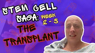 STEM CELL SAGA The Transplant  HARDEST thing I’ve ever done [upl. by Klatt870]