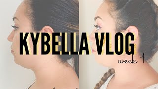 KYBELLA WEEK 1 VLOG  Full Process  Procedure  Downtime  Results  Before amp After [upl. by Danelle45]