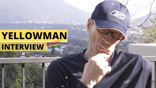 Yellowman Interview quotBattle With Skin Cancerquot [upl. by Hpeosj350]