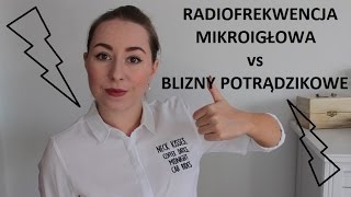 RADIOFREKWENCJA MIKROIGŁOWA kontra BLIZNY POTRĄDZIKOWE [upl. by Netfa]