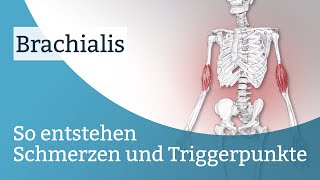 Brachialis Schmerzen Triggerpunkte und deren Aktivierung [upl. by Beesley]