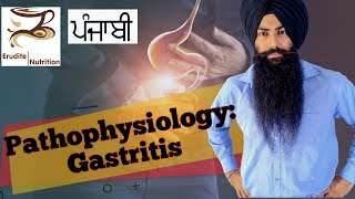 What is Gastritis Types amp Causes 13 Punjabi Audio [upl. by Skvorak]