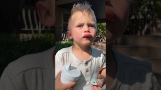 2 Year Old Bee Sting or Lip Filler My son is a little champ 🥹 The sweetest reaction beesting [upl. by Karlise]