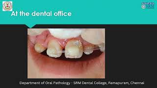 Management of Avulsed Tooth  Dr Priyadharsini N  Department of Oral Pathology [upl. by Giguere186]