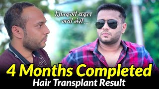 4 Months Result Review  Hair Transplant 😍 [upl. by Woodcock]