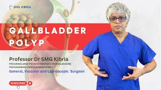 What is Gallbladder Polyp Causes Signs Symptoms and Treatment । Things You Need To Know [upl. by Frye]