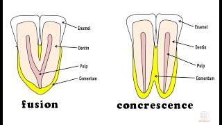 Developmental disturbances in shape of teeth  Part 1 [upl. by Attelrac]