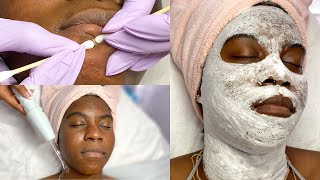 Deep Cleansing Oxygen Facial  Close Up Extractions [upl. by Laszlo]